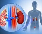 Book Kidney Function Test (KFT) in Ghana
